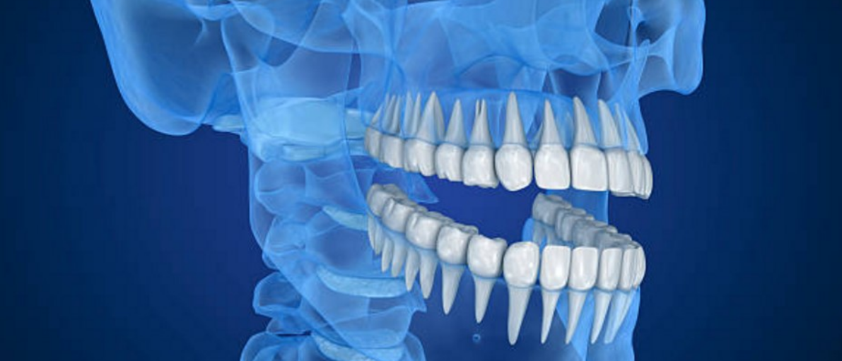 Disfunción Cráneomandibular